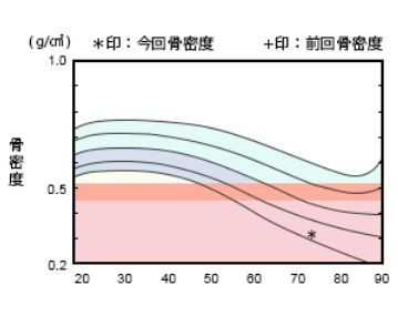 POINT03 骨粗鬆症検査が可能！