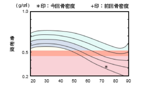 POINT01 骨粗鬆症検査が可能